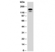 Western blot testing of human HeLa lysate with MSH6 antibody (clone MTS6-1). Expected molecular weight: 120-160 kDa depending on phosphorylation level.