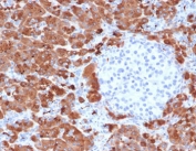 IHC testing of FFPE human pancreas with Carboxypeptidase A1 antibody (clone CBPA1-1). HIER: boil tissue sections in pH6, 10mM citrate buffer, for 10-20 min followed by cooling at RT for 20 min.