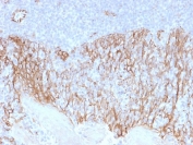 IHC testing of FFPE human tonsil tissue with Beta Catenin antibody (clone CTNNB1/2099). HIER: boil tissue sections in pH6, 10mM citrate buffer, for 10-20 min followed by cooling at RT for 20 min.