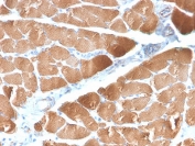 IHC testing of FFPE human skeletal muscle with recombinant Desmin antibody (clone DES/2960R). Required HIER: boil tissue sections in 10mM Tris with 1mM EDTA, pH 9 for 10-20 min and allow to cool before testing. 