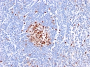 IHC staining of FFPE human tonsil with PCNA antibody (clone PC5). HIER: boil tissue sections in pH 9 10mM Tris with 1mM EDTA for 20 min and allow to cool before testing.