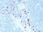 IHC staining of FFPE human tonsil with Mast Cell Tryptase antibody (clone TPSAB1/1963). HIER: boil tissue sections in pH 9 10mM Tris with 1mM EDTA for 20 min and allow to cool before testing.