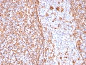 IHC staining of FFPE human tonsil with recombinant Vimentin antibody (clone VIM/1937R). HIER: boil tissue sections in pH 9 10mM Tris with 1mM EDTA for 20 min and allow to cool before testing.