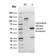 SDS-PAGE analysis of purified, BSA-free TLR4 antibody (clone TLR4/3895R) as confirmation of integrity and purity.
