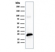 Western blot testing of human COLO-38 cell lysate with recombinant MART-1 antibody (clone MLANA/4475R). Expected molecular weight ~20 kDa with possible doublet.