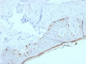 IHC staining of FFPE human skin with recombinant MART-1 antibody (clone MLANA/4385R). HIER: boil tissue sections in pH 9 10mM Tris with 1mM EDTA for 20 min and allow to cool before testing.