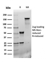 SDS-PAGE analysis of purified, BSA-free CD31 antibody (r6439) as confirmation of integrity and purity.