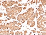 IHC staining of FFPE human pituitary gland tissue with recombinant ACTH antibody (clone rCLIP/3814) at 2ug/ml. HIER: boil tissue sections in pH 9 10mM Tris with 1mM EDTA for 20 min and allow to cool before testing.
