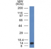 Western blot testing of a recombinant ALK partial protein using Anaplastic Lymphoma Kinase antibody (clone ALK/1032).