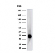 Western blot testing of human Jurkat cell lysate using recombinant CD3 epsilon antibody (clone C3e/4653R). Predicted molecular weight ~23 kDa.