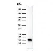 Western blot testing of human HeLa cell lysate using recombinant Fatty Acid Binding Protein 5 antibody (clone FABP5/6353R). Predicted molecular weight ~15 kDa.