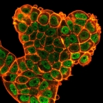 Immunofluorescent staining of PFA-fixed human MCF-7 cells using Bcl6 antibody (green, clone PCRP-BCL6-1D3) and phalloidin (red).