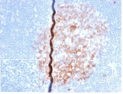 IHC staining of FFPE human lymph node with recombinant CD86 antibody (clone rC86/6872) at 2ug/ml in PBS for 30min RT. Negative control inset: PBS instead of primary antibody to control for secondary binding. HIER: boil tissue sections in pH 9 10mM Tris with 1mM EDTA for 20 min and allow to cool before testing.