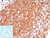 IHC staining of FFPE human tonsil tissue with CD74 antibody (clone CLIP/6609) at 2ug/ml. Negative control inset: PBS used instead of primary antibody to control for secondary Ab binding. HIER: boil tissue sections in pH 9 10mM Tris with 1mM EDTA for 20 min and allow to cool before testing.
