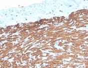 IHC staining of FFPE human small intestine tissue with Desmin antibody (clone DES/4526). HIER: boil tissue sections in pH 9 10mM Tris with 1mM EDTA for 20 min and allow to cool before testing.