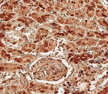 Albumin Antibody Human Kidney Tissue IHC. Immunohistochemistry staining testing of FFPE human kidney tissue with Albumin antibody. HIER: steam section in pH9 EDTA for 20 min and allow to cool prior to staining.