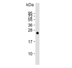 Western blot testing of human brain tissue lysate with MitoPLD antibody. Predicted molecular weight ~28 kDa.