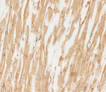 RNF4 Antibody / E3 Ubiquitin-Protein Ligase RNF4 Antibody. Immunohistochemistry analysis of RNF4 in FFPE human heart tissue. IHC staining of FFPE human heart using RNF4 Antibody / E3 Ubiquitin-Protein Ligase RNF4 Antibody demonstrates HRP-DAB brown staining within cardiomyocytes, with signal primarily localized to intracellular compartments consistent with nuclear and perinuclear distribution of this E3 ubiquitin ligase. The staining pattern reflects cellular regions associated with ubiquitin-mediated protein regulation and SUMO-targeted ubiquitination activity, while surrounding tissue architecture remains clearly defined.