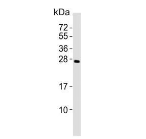 RNF4 Antibody / E3 Ubiquitin-Protein Ligase RNF4 Antibody for WB. Western blot analysis of RNF4 in human kidney tissue lysate. Lane 1: human kidney tissue lysate. A band is detected at approximately 28 kDa, consistent with the predicted molecular weight of E3 ubiquitin-protein ligase RNF4 (isoform 1). The observed signal aligns with expression of this nuclear E3 ubiquitin ligase, which functions in SUMO-targeted ubiquitination and regulation of protein degradation pathways.