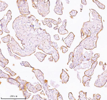 Immunohistochemical staining of TNIK using anti-TNIK antibody. TNIK was detected in a paraffin-embedded section of human placenta tissue. Heat mediated antigen retrieval was performed in EDTA buffer (pH 8.0, epitope retrieval solution). The tissue section was blocked with 10% goat serum. The tissue section was then incubated with 2 ug/ml rabbit anti-TNIK antibody overnight at 4oC. Peroxidase Conjugated Goat Anti-rabbit IgG was used as secondary antibody and incubated for 30 minutes at 37oC. The tissue section was developed using an HRP secondary and DAB substrate.
