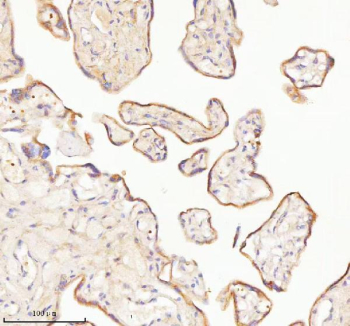 Immunohistochemical staining of TNIK using anti-TNIK antibody. TNIK was detected in a paraffin-embedded section of human placenta tissue. Heat mediated antigen retrieval was performed in EDTA buffer (pH 8.0, epitope retrieval solution). The tissue section was blocked with 10% goat serum. The tissue section was then incubated with 2 ug/ml rabbit anti-TNIK antibody overnight at 4oC. Peroxidase Conjugated Goat Anti-rabbit IgG was used as secondary antibody and incubated for 30 minutes at 37oC. The tissue section was developed using an HRP secondary and DAB substrate.
