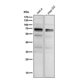 All lanes use the Phospho-PKC alpha (pThr497) antibody at 1:1000 dilution for 1 hour at room temperature.