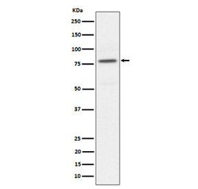 Western blot analysis of Phospho-PKC alpha (pT497) expression in HeLa treated with Calyculin A cell lysate, using Phospho-PKC alpha (Thr497) antibody.