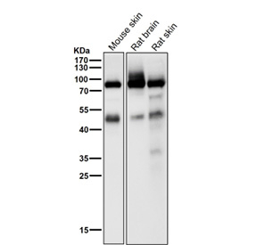 All lanes use the Phospho-PKC alpha (pThr497) antibody at 1:1000 dilution for 1 hour at room temperature.