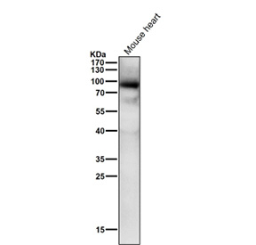 All lanes use the Phospho-PKC alpha (pThr497) antibody at 1:1000 dilution for 1 hour at room temperature.
