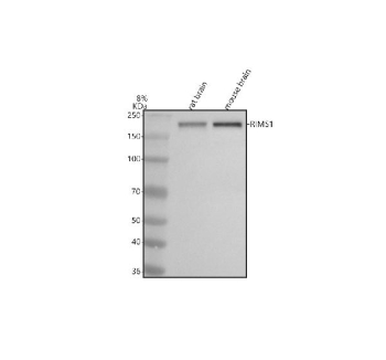 Western blot analysis of RIM1/RIMS1 using anti-RIMS1 antibody. Electrophoresis was performed on a 8% SDS-PAGE gel at 80V (Stacking gel) / 120V (Resolving gel) for 2 hours. Lane 1: rat brain tissue lysates, Lane 2: mouse brain tissue lysates. After electrophoresis, proteins were transferred to a nitrocellulose membrane at 150 mA for 50-90 minutes. Blocked the membrane with 5% non-fat milk/TBS for 1.5 hour at RT. The membrane was incubated with rabbit anti-RIMS1 antibody at 0.5 ug/ml overnight at 4oC, then washed with TBS-0.1%Tween 3 times with 5 minutes each and probed with a goat anti-rabbit IgG-HRP secondary antibody at a dilution of 1:5000 for 1.5 hour at RT. The signal was developed using an ECL Plus Western Blotting Substrate. A specific band was detected for RIM1/RIMS1 at approximately 189 kDa. The expected molecular weight of RIM1/RIMS1 is at 189 kDa.