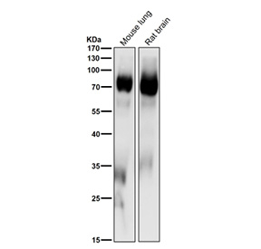 All lanes use the PKC delta/theta Antibody at 1:1000 dilution for 1 hour at room temperature. Predicted molecular weight: 68-82 kDa.
