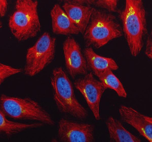 GALNT2 Antibody HeLa Cell IF. Immunofluorescence analysis of HeLa cells using GALNT2 Antibody (green) and alpha tubulin antibody (red). Cells were treated with enzyme antigen retrieval reagent for 15 minutes prior to blocking with goat serum and overnight incubation with GALNT2 Antibody (5 ug/mL) and alpha tubulin antibody at 4°C. Fluoro488- and Cy3-conjugated secondary antibodies were used for detection, and DAPI (blue) was used as a nuclear counterstain. GALNT2 displays concentrated perinuclear staining consistent with Golgi localization, while alpha tubulin highlights the cytoskeletal network. These results support the use of GALNT2 Antibody / O-Glycosylation Enzyme Antibody for studying GALNT2 expression, Golgi organization and protein O-glycosylation.