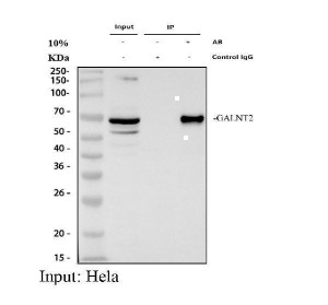 GALNT2 Antibody HeLa Cell IP. Immunoprecipitation of GALNT2 from HeLa whole cell lysate using GALNT2 Antibody, followed by Western blot analysis with the same antibody. Lane 1: HeLa input lysate (30 ug); Lane 2: rabbit control IgG immunoprecipitation; Lane 3: GALNT2 immunoprecipitation using 2 ug of GALNT2 Antibody from 500 ug of HeLa lysate. A specific band is enriched at approximately 65-70 kDa in the GALNT2 immunoprecipitation sample, while no corresponding GALNT2 band is detected in the control IgG lane, confirming specific enrichment of endogenous GALNT2. These results support the use of GALNT2 Antibody / O-Glycosylation Enzyme Antibody for immunoprecipitation, protein interaction studies and investigations of Golgi-associated O-glycosylation pathways.