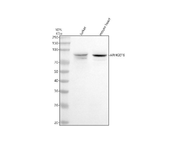 Western blot analysis of ARHGEF6 using anti-ARHGEF6 antibody. Lane 1: human Jurkat whole cell lysates, Lane 2: mouse heart tissue lysates. After electrophoresis, proteins were transferred to a nitrocellulose membrane at 150 mA for 50-90 minutes. Blocked the membrane with 5% non-fat milk/TBS for 1.5 hour at RT. The membrane was incubated with rabbit anti-ARHGEF6 antibody at 0.5 ug/ml overnight at 4oC, then washed with TBS-0.1%Tween 3 times with 5 minutes each and probed with a goat anti-rabbit IgG-HRP secondary antibody at a dilution of 1:5000 for 1.5 hour at RT. The signal was developed using enhanced chemiluminescent. Western blot analysis of ARHGEF6 in human and mouse lysates shows the expected ~87 kDa band appearing as a doublet, consistent with reported phosphorylated and unmodified forms of ARHGEF6.