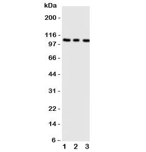 ADAMTS1 Antibody Rat Tissues WB. Western blot analysis of ADAMTS1 expression using an ADAMTS1 antibody. Lane 1: rat liver tissue lysate. Lane 2: rat heart tissue lysate. Lane 3: rat brain tissue lysate. ADAMTS1, also known as ADAM Metallopeptidase with Thrombospondin Type 1 Motif 1, is a secreted extracellular matrix protease involved in tissue remodeling and angiogenesis. A prominent band is detected at approximately 100 kDa in all tissues, consistent with the expected molecular weight range of 84 to 120 kDa. The apparent molecular weight of ADAMTS1 can vary due to glycosylation and proteolytic processing. These results demonstrate endogenous expression of ADAMTS1 in rat tissues and support the utility of ADAMTS1 Antibody for studies of extracellular matrix remodeling, vascular biology, and tissue homeostasis.