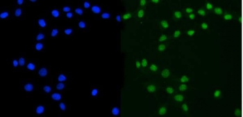 Immunofluorescent staining of FFPE human MCF7 cells with ATXN3 antibody (green) and DAPI nuclear stain (blue). HIER: steam section in pH6 citrate buffer for 20 min.