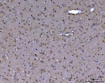 IHC testing of FFPE mouse brain tissue with ABL2 antibody. HEIR: Boil the paraffin sections in pH8 EDTA buffer for 20 minutes and allow to cool prior to testing.