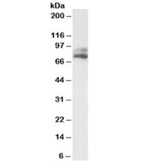 Western blot testing of human HepG2 lysate with VPS16 antibody at 1ug/ml. Predicted molecular weight: ~95/78kDa (isoforms 1/2).