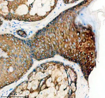 Immunohistochemical staining of FFPE human skin tissue with KRT5 antibody, HRP-secondary and DAB substrate. HIER: boil tissue sections in pH8 EDTA for 20 min and allow to cool before testing.