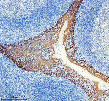 Immunohistochemical staining of FFPE human tonsil tissue with KRT5 antibody, HRP-secondary and DAB substrate. HIER: boil tissue sections in pH8 EDTA for 20 min and allow to cool before testing.
