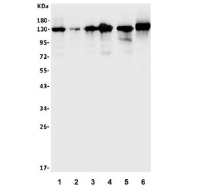 Western blot testing of human 1) HeLa, 2) MCF7, 3) SW620, 4) HepG2, 5) rat RH35 and 6) mouse HEPA1-6 lysate with TIF1 alpha anti