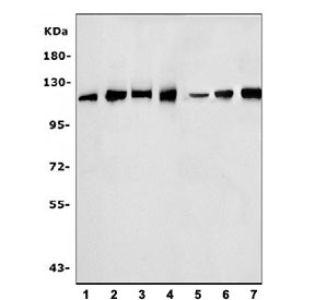 Western blot testing of human 1) HeLa, 2) Raji, 3) U-87 MG, 4) HUVEC, 5) rat stomach, 6) rat pancreas and 7) mouse stomach tissue lysate with SND1 antibody. Predicted molecular weight ~102 kDa.
