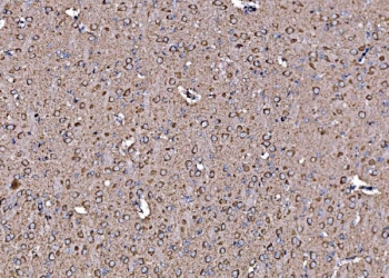 IHC staining of FFPE rat brain tissue with DLAT antibody. HIER: boil tissue sections in pH8 EDTA for 20 min and allow to cool before testing.