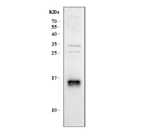 Western blot testing of human HeLa cell lysate with LDOC1 antibody. Predicted molecular weight ~17 kDa.