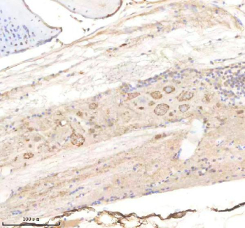 Zebrafish Pik3cb Antibody Spinal Cord Tissue IHC. Immunohistochemistry staining of FFPE zebrafish spinal cord tissue with Pik3cb antibody, HRP-labeled secondary and DAB substrate. HIER: boil tissue sections in pH8 EDTA for 20 min and allow to cool before testing.