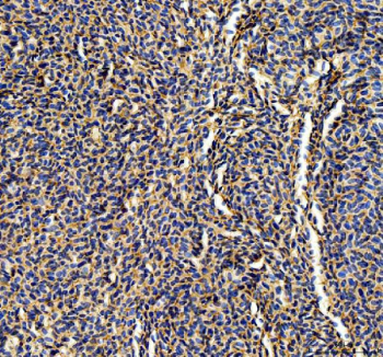 Zebrafish Abcc12 Antibody Liver Tissue IHC. Immunohistochemistry staining of FFPE zebrafish liver tissue with Abcc12 antibody, HRP-labeled secondary and DAB substrate. HIER: boil tissue sections in pH8 EDTA for 20 min and allow to cool before testing.