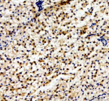 Zebrafish Abcc12 Antibody Colon Tissue IHC. Immunohistochemistry IHC staining of FFPE zebrafish colon tissue with Abcc12 antibody, HRP-labeled secondary and DAB substrate. HIER: boil tissue sections in pH8 EDTA for 20 min and allow to cool before testing.