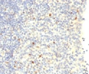 IHC testing of human tonsil with FOXP3 antibody.