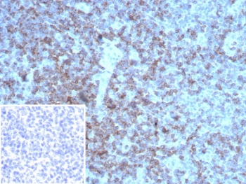Immunohistochemistry analysis of LFA-2 antibody (clone rLFA2/8516) in human tonsil tissue. Formalin-fixed, paraffin-embedded tonsil shows strong membranous HRP-DAB brown staining in interfollicular T lymphocytes, consistent with CD2 expression on mature T cells. Germinal center regions display comparatively reduced staining, highlighting the expected distribution of T cell populations within lymphoid tissue. Hematoxylin counterstain clearly delineates nuclear morphology and overall tonsillar architecture. The inset shows PBS used in place of primary antibody as a negative control, confirming absence of non-specific secondary antibody binding. Heat-induced epitope retrieval was performed by boiling tissue sections in 10 mM Tris with 1 mM EDTA, pH 9.0, for 20 minutes followed by cooling prior to staining.