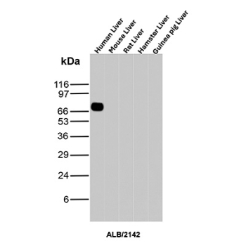 Albumin Antibody Multi-Species Liver WB. Western blot analysis of human, mouse, rat, hamster, and guinea pig liver tissue lysates using microarray validated Albumin antibody detects a strong band at approximately 65-70 kDa in human liver, consistent with the predicted molecular weight of Albumin (ALB), with minimal signal observed in other species under these conditions; detection was performed with clone ALB/2142.
